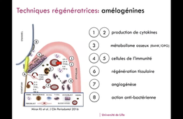 D5_Pr Kevimy Agossa_Biomat de régénération parodontale.mp4