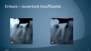2026-04-01  P2  Pr Robberecht.mp4