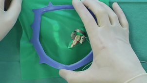 Pose de digue fendue .mp4