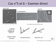 4A corrections cas 5 et 6 TP Mycologie Médicale