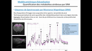 Pharmacologie et imagerie : IRM