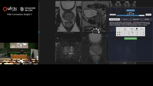 Cours Pr PUECH - mercredi 22 octobre - 9h00 à 10h00