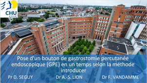 Gastrostomie percutanée endoscopique (GPE) selon la méthode introducer avec pose d'un bouton en un temps
