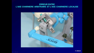 Utilisation de l'articulateur en prothèse fixée - 2ème partie - D5.avi