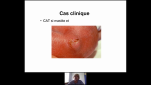 DIU LACTATION MATERNELLE 19-05-2021 PARTIE 3