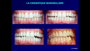 L'analyse occlusale - D4.avi