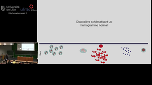 Séminaire Hematologie 26 02 24.mp4