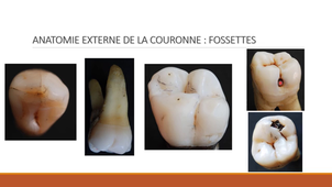 Anatomie descriptive des dents humaines P2.mp4