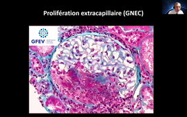 2021-2022 GPA Cours 19 DIU 2021 Puéchal 20 mn.mp4